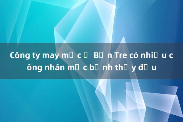 Công ty may mặc ở Bến Tre có nhiều công nhân mắc bệnh thủy đậu